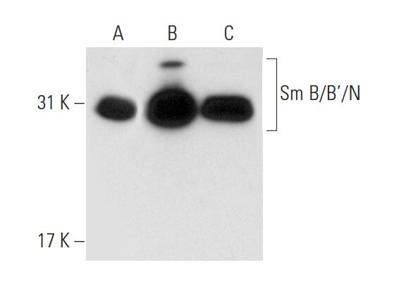 Sm B/B'/N Antibody (12F5) | SCBT - Santa Cruz Biotechnology