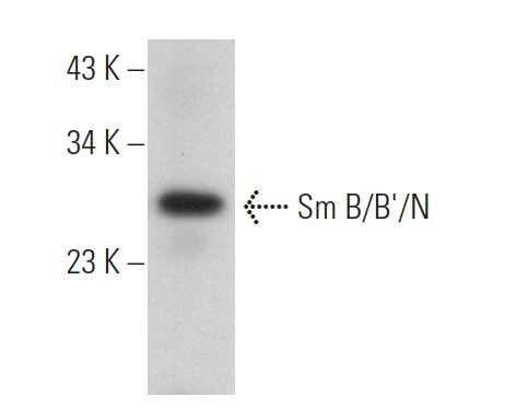 Sm B/B'/N Antibody (12F5) | SCBT - Santa Cruz Biotechnology