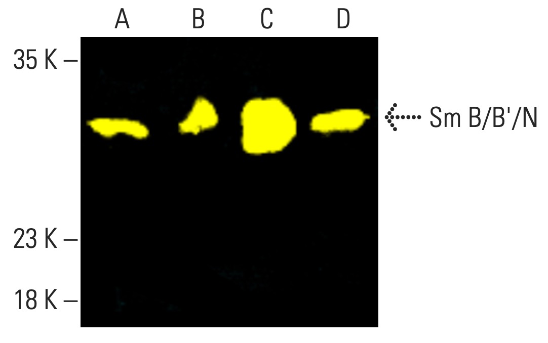 Sm B/B'/N Antibody (12F5) | SCBT - Santa Cruz Biotechnology