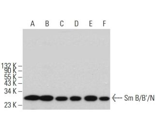 Anti Sm B B N Antibody H 9 Scbt Santa Cruz Biotechnology