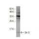 Sm G Antibody (K-15) - Western Blotting - Image 34510