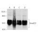 This polyclonal antibody has been discontinued. See our recommended <a href="smad2-3-antibody-c-8">Smad2/3 (C-8)</a> monoclonal antibody (sample data shown). western blotting image from recommended Smad2/3 (C-8) monoclonal antibody replacement. Image 59787
