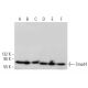 This polyclonal antibody has been discontinued. See our recommended <a href="smad4-antibody-b-8">Smad4 (B-8)</a> monoclonal antibody (sample data shown). western blotting image from recommended Smad4 (B-8) monoclonal antibody replacement. Image 370892