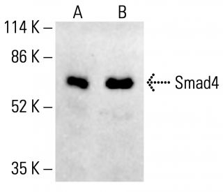 Smad4 Antibody (B-8) - Western Blotting - Image 412444