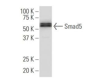Smad5 Antibody (YY-6) - Western Blotting - Image 34511The Double Nickase Plasmid features a U6 promoter for sgRNA expression, a 20 nt targeting sequence, and a gRNA scaffold to guide Cas9n. It includes a CBh promoter for Cas9n (D10A) and puromycin resistance, GFP for transfection verification, and nuclear localization signals (NLS). The 2A peptide allows co-expression of Cas9n and Puro from a single promoter, enabling precise genome editing with reduced off-target effects. 
