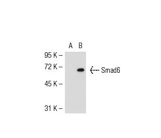 Smad6 Antibody (D-4) - Western Blotting - Image 52920Each CRISPR/Cas9 Knockout (KO) Plasmid product consists of a pool of 3 plasmids designed to ensure identification and cleavage of a specific gene for maximum knockout efficiency. Each plasmid encodes a unique 20 nt sequence derived from the GeCKO (v2) library. 