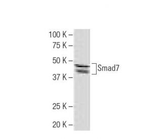 Spotlijster ironie zelf Anti-Smad7 Antibody (Z8-B) | SCBT - Santa Cruz Biotechnology