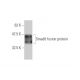 western blotting image from recommended Smad8 (3E5) monoclonal antibody replacement. Image 348538
