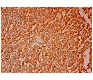 SMAP1 Antibody (H-11) - Immunohistochemistry - Image 304840 