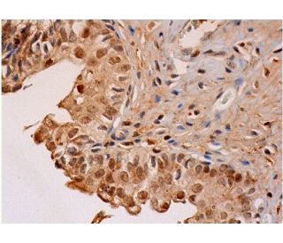 SmarcAL1 Antibody (A-2) - Immunohistochemistry - Image 286312 