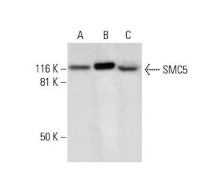 SMC5 Antibody (B-11) - Western Blotting - Image 294488