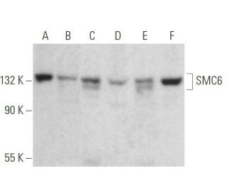 SMC6 Antibody (A-3) - Western Blotting - Image 358978 