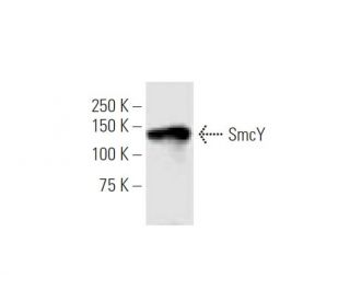 SmcY Antibody (4C6) - Western Blotting - Image 347589 