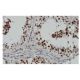SMG1 Antibody (6-RE13) - Immunohistochemistry - Image 65054