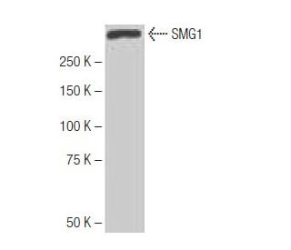 SMG1 Antibody (6-RE13) - Western Blotting - Image 65055 