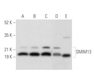 SMIM13 Antibody (E-6) - Western Blotting - Image 304349 