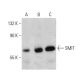 SMIT Antibody (3A6) - Western Blotting - Image 384075 