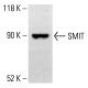 SMIT Antibody (3A6) - Western Blotting - Image 414184