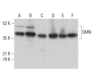 SMN Antibody (11F3) - Western Blotting - Image 377988 