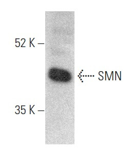 SMN Antibody (2B1) | SCBT - Santa Cruz Biotechnology