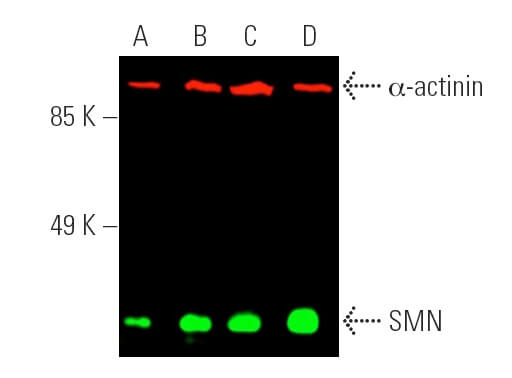 SMN Antibody (2B1) | SCBT - Santa Cruz Biotechnology