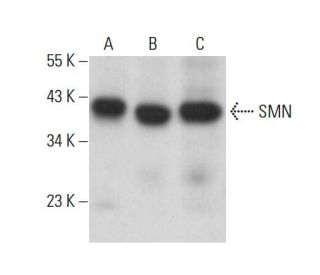 SMN Antibody (MANSMA1) - Western Blotting - Image 377991 