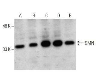 western blotting image from recommended SMN (2B1) monoclonal antibody replacement. Image 366649