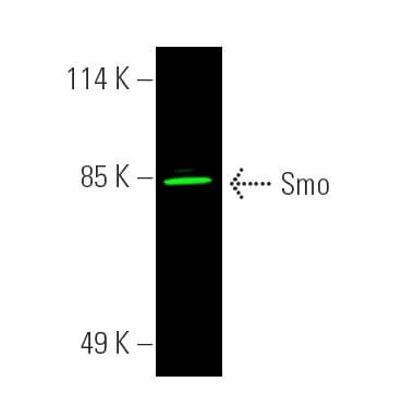 SMO/Smoothened Anticuerpo (E-5): sc-166685