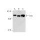This polyclonal antibody has been discontinued. See our recommended <a href="smo-antibody-e-5">SMO/Smoothened (E-5)</a> monoclonal antibody (sample data shown). western blotting image from recommended SMO/Smoothened (E-5) monoclonal antibody replacement. Image 138377
