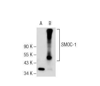 SMOC-1 Antibody (C-2) - Western Blotting - Image 54067