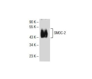 SMOC-2 Antibody (F-11) - Western Blotting - Image 153967