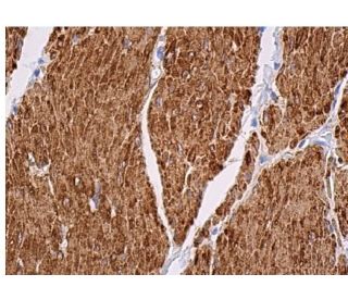 Smooth Muscle Actin Antibody (B4) - Immunohistochemistry - Image 361425