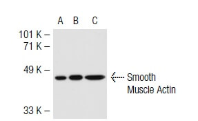 Smooth Muscle Actin Antibody B4 SCBT Santa Cruz