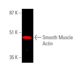 Smooth Muscle Actin Antibody (B4): m-IgG Fc BP-HRP Bundle