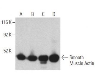 Smooth Muscle Actin Antibody CGA7 SCBT Santa Cruz Biotechnology