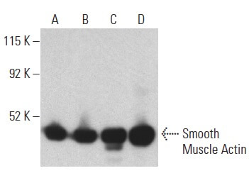 Smooth Muscle Actin Antibody CGA7 SCBT Santa Cruz Biotechnology