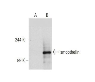 smoothelin Antibody (2Q1120) - Western Blotting - Image 130888 