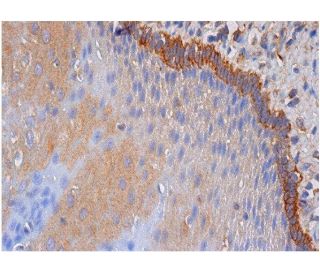immunohistochemistry image from recommended smoothelin (C-8) monoclonal antibody replacement. Image 284703