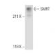 SMRT Antibody (1212) - Western Blotting - Image 11020
