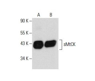 sMtCK Antibody (C-6) - Western Blotting - Image 288499 