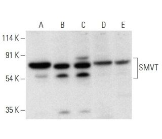 SMVT Antibody (C-9) - Western Blotting - Image 318461 