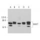 SMVT Antibody (C-9) - Western Blotting - Image 365482 