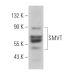 SMVT Antibody (C-9) - Western Blotting - Image 366089