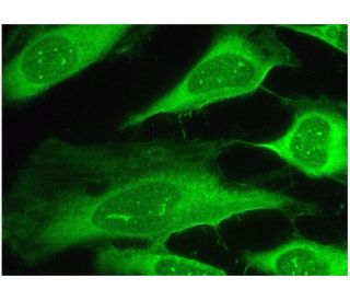 SMVT Antibody (D-11) - Immunofluorescence - Image 298787 