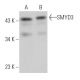 SMYD3 Antibody (C-3) - Western Blotting - Image 363530 