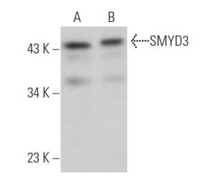 SMYD3 Antibody (C-3) - Western Blotting - Image 363530Each CRISPR/Cas9 Knockout (KO) Plasmid product consists of a pool of 3 plasmids designed to ensure identification and cleavage of a specific gene for maximum knockout efficiency. Each plasmid encodes a unique 20 nt sequence derived from the GeCKO (v2) library.