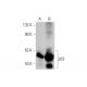 SN 38: sc-203697. Western blot analysis of p53 expression in untreated (A) and SN 38 treated (B) HCT 116 whole cell lysate