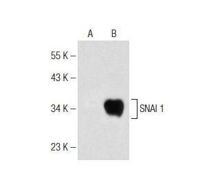 セントクリストファー
 チェック柄 トップスとプリーツスカートセット SNAI 1 Antibody (G-7) | SCBT - Santa Cruz Biotechnology