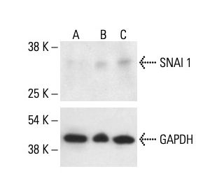 セントクリストファー
 チェック柄 トップスとプリーツスカートセット SNAI 1 Antibody (G-7) | SCBT - Santa Cruz Biotechnology