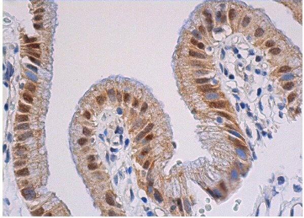 SNAI 1 Antibody (H-130) | SCBT - Santa Cruz Biotechnology